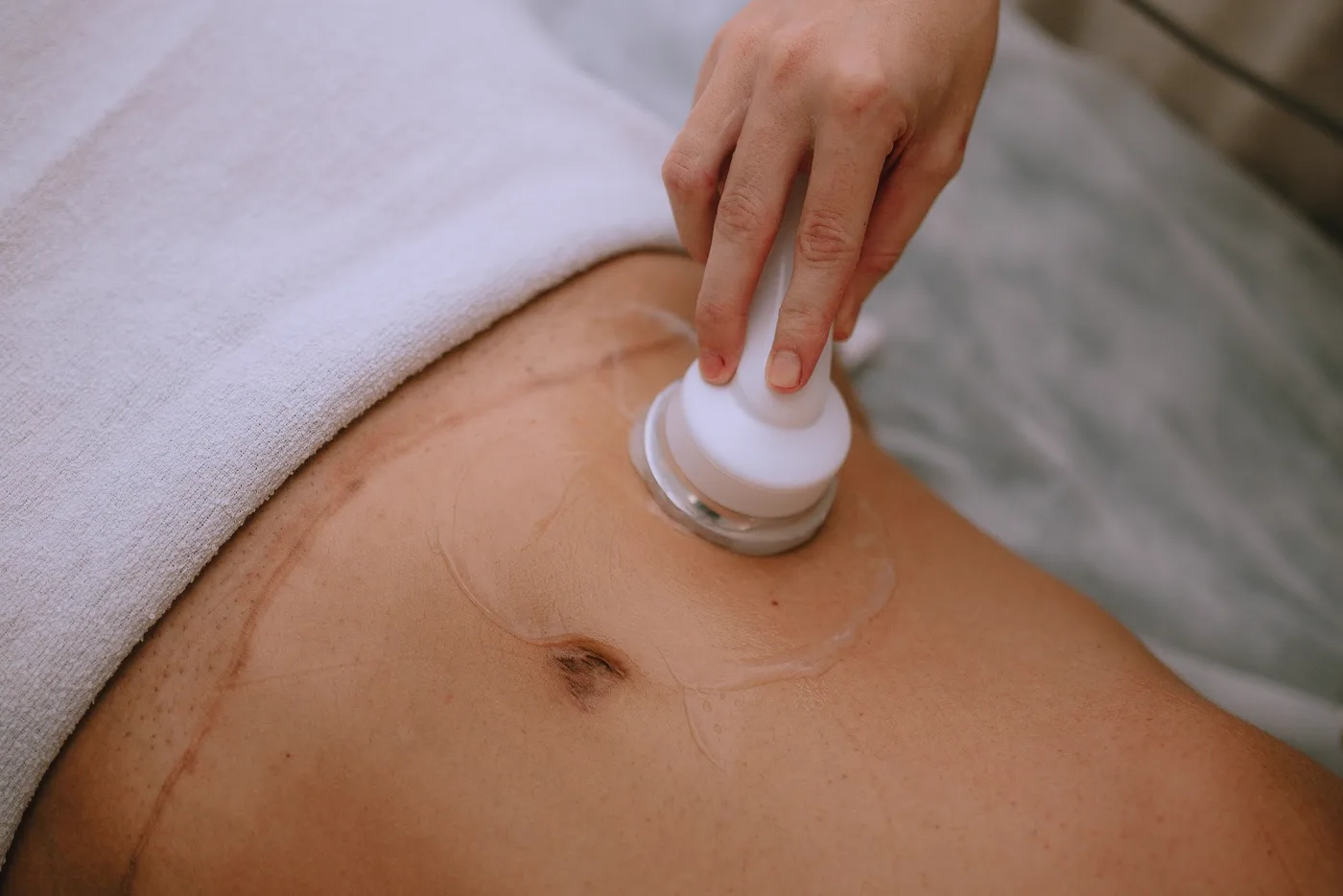 Procedimento corporal com ultrassom